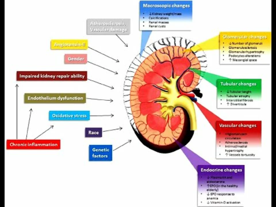 The Connection between Hodgkin's Disease and Kidney Disease